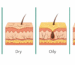 Skin Types Classification